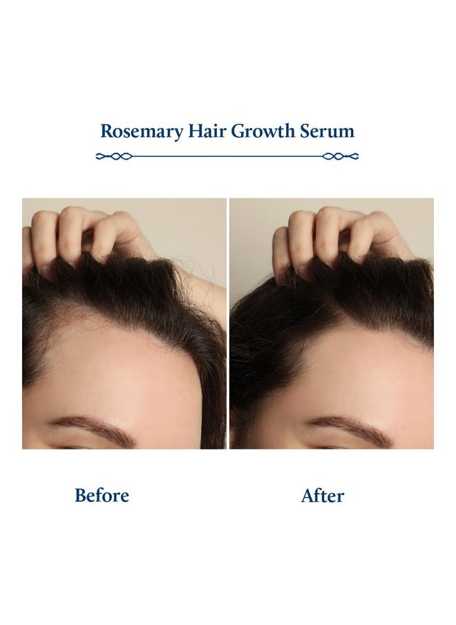 Blue Nectar Advanced Plant Based Rosemary Hair Growth Serum, Natural Alternate for Redensyl for Hair Growth | Intensive Ayurvedic Hair Serum for Women & Men for Healthy Hair & Scalp with Bhringraj (8 Herbs, 100 ml)