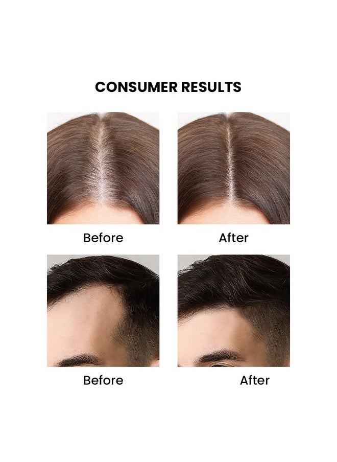 ThriveCo Rosemary Essential Oil For Hair Growth & Hair Fall Control | Reduces Hair Breakage & Improves Scalp Health | 100% Pure, Certified Organic & Natural | With Vitamin E | For Men & Women | 15ml