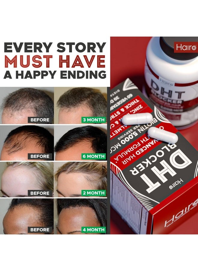 DHT Blocker Hair Growth Supplement - High Potency Biotin & Saw Palmetto for Hair Regrowth - Natural Hair Loss Treatments for Women & Men - Helps Stimulate Hair Follicle Growth