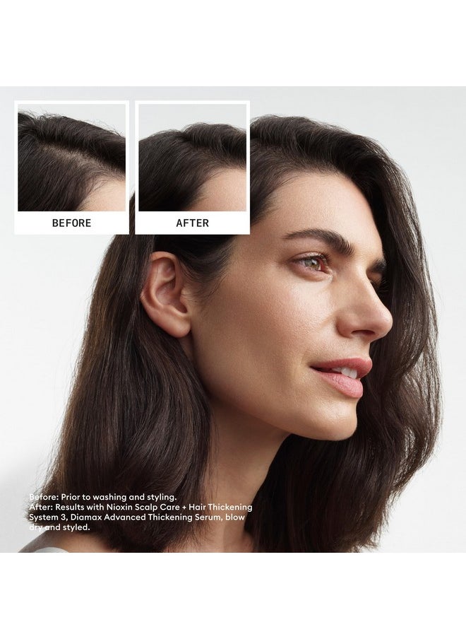 Nioxin System 3 Scalp + Hair Thickening Treatment- Serum for Damaged Hair with Light Thinning, 6.8 oz (Packaging May Vary)