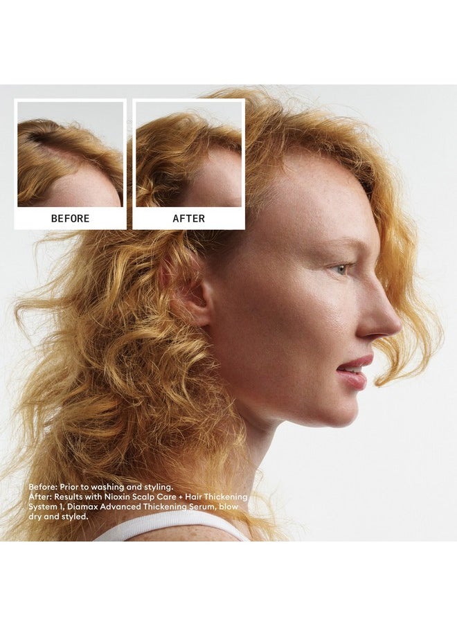 Nioxin Scalp + Hair Thickening System 1 Leave on Treatment, For Natural Hair with Light Thinning, 6.8 oz (Packaging May Vary)