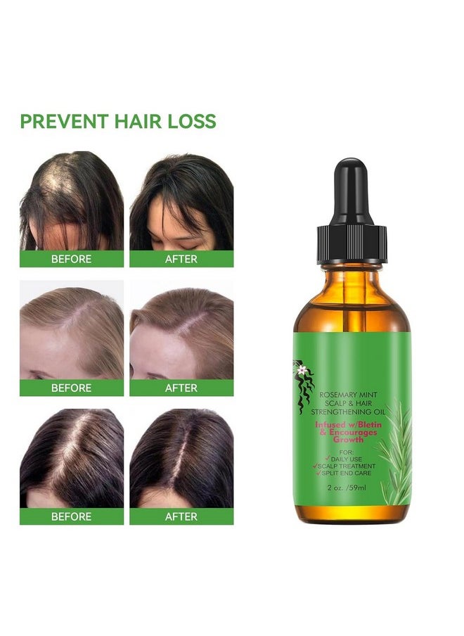Rosemary Hair Growth Oil and Serum - Dry Scalp Treatment, Hair Thickening Products for Women, Hair Loss Essential Oils for Diffuser (2OZ)