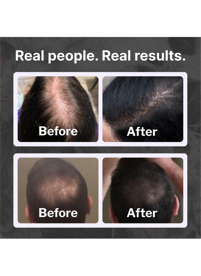 Shapiro MD Hair Growth Experts Hair Loss Shampoo | DHT Fighting Vegan Formula for Thinning Hair Developed by Dermatologists | Experience Healthier, Fuller and Thicker Looking Hair | 1 Month Supply