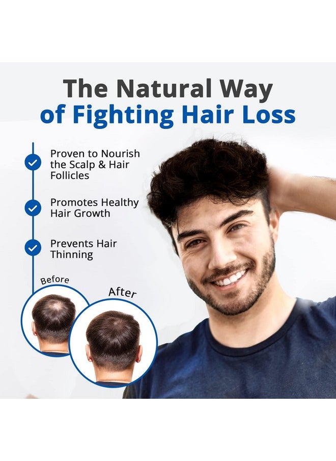 HAIRMETTO Serum for Hair Loss and Regrowth with Saw Palmetto, Stinging Nettle, Rosemary Oils, Peppermint Scent, Unisex,4oz