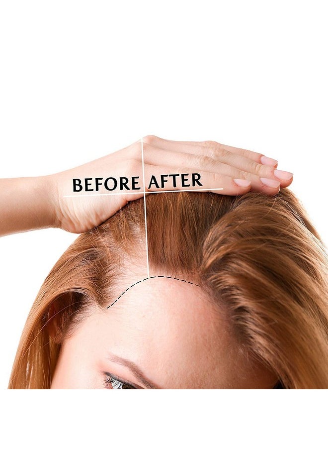 Luv Me Care Biotin Hair Growth Oil Hair Growth Serum for Thicker Longer Fuller Healthier Hair, Prevent Hair Loss & Thinning, All Natural Vitamin Rich Treatment, Women & Men, All Hair Types 1.7 oz