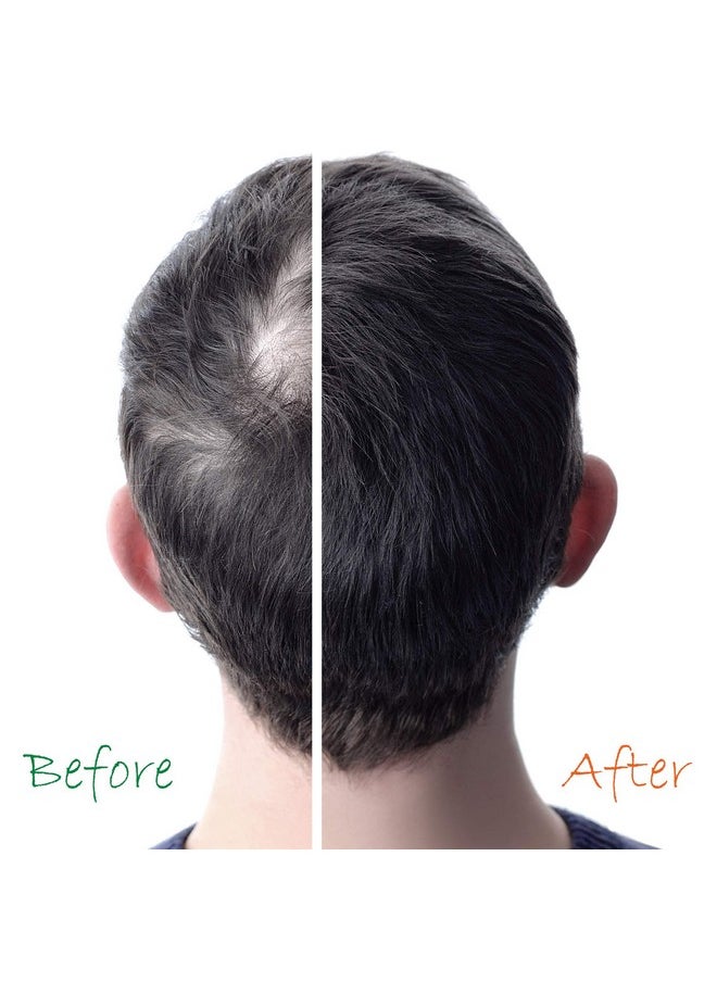 Hair Growth Booster Anti-Aging Serum B5-Vitamin Treatment (2 Pack) 6 oz - Non Sulfate Formula - for Color Treated Hair - Premium Thinning Solution - Growth for Men & Women | Organic Hair Energizer