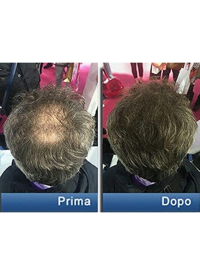 Pantogar (Pantovigar) Specific Treatment for Hair and Nails - 90 Cap