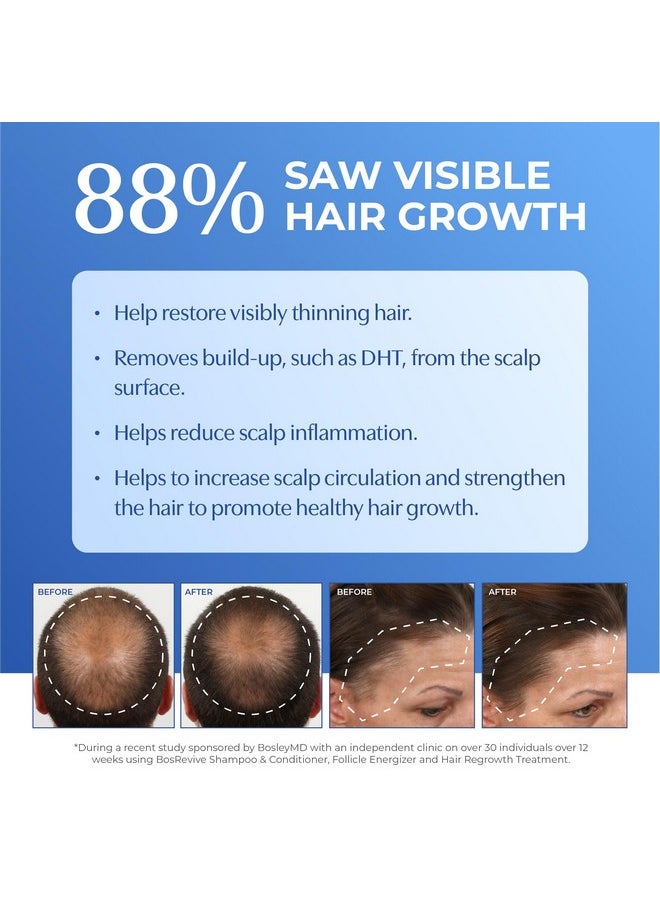 BosleyMD BosRevive KIT for Visible Hair Thinning (Non Color-Treated), Starter Size (30 Days)