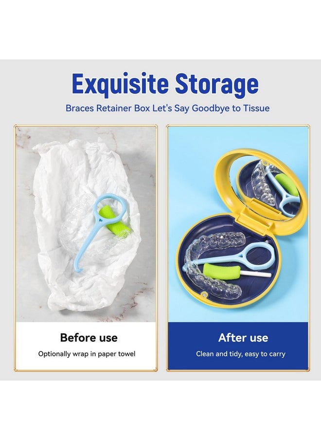 Annhua Dental Mouthguard Case Orthodontic Retainer Case with Mirror, Denture Holder Box Mouthpiece Case Partial Denture Case Nightguard Dental Box - White