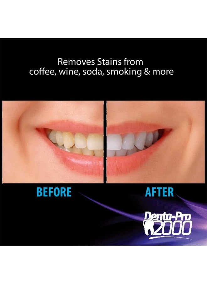 DentaPro 2000 3D Teeth Whitening Kit - Deluxe Addition Includes LED Light, (2) 5ml Gel Syringes, Custom Moldable Tray (2), Vitamin E Swab (2), Shade Guide - See Results After Just One Use!