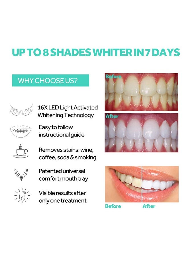 Teeth Whitening Accelerator Light, 16x More Powerful Blue LED Light, Mouth Tray Teeth Whitening Enhancer Light Trays Connected with iPhone/Micro-USB Android/USB for Home Use