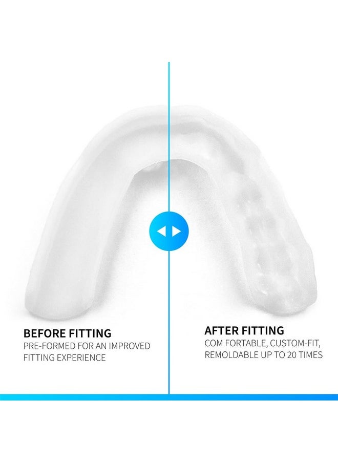 SOVA 3D Night Guard - 2.0mm Thin - Custom-Molded Fit - Protects Against Nighttime Teeth Grinding & Clenching - Odor & Taste Free - Remoldable Up to 20 Times - Non Toxic