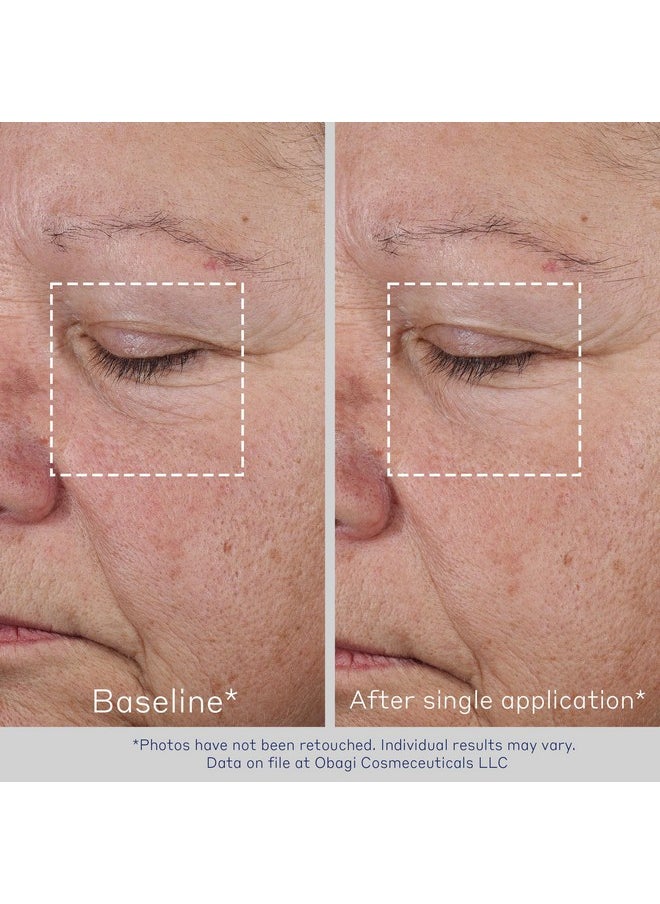 Obagi ELASTIderm Advanced Filler Concentrate - Clinically Proven Non-Injectable Instant Filler that Visibly Reduces the Appearance of Fine Lines - 0.68 oz
