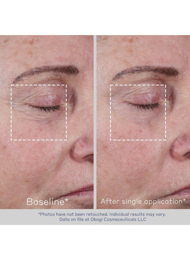 Obagi ELASTIderm Advanced Filler Concentrate - Clinically Proven Non-Injectable Instant Filler that Visibly Reduces the Appearance of Fine Lines - 0.68 oz