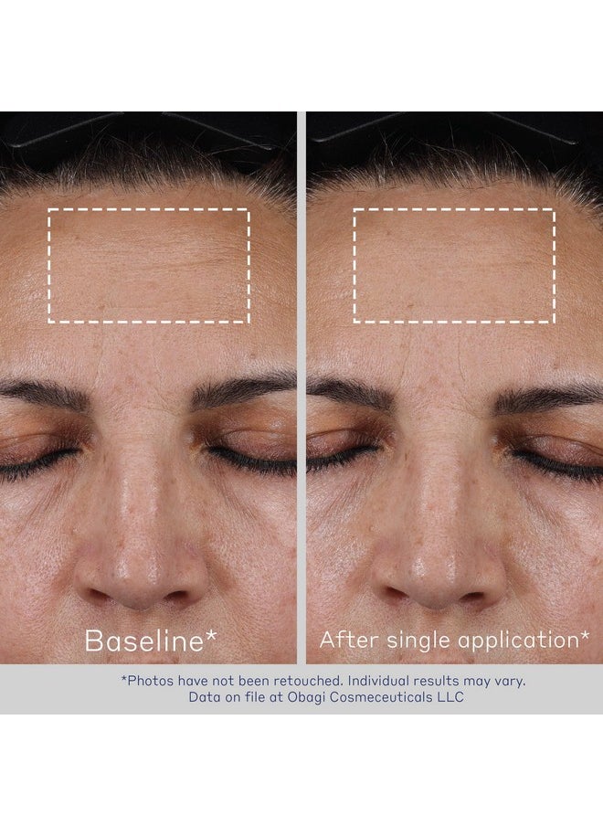 Obagi ELASTIderm Advanced Filler Concentrate - Clinically Proven Non-Injectable Instant Filler that Visibly Reduces the Appearance of Fine Lines - 0.68 oz