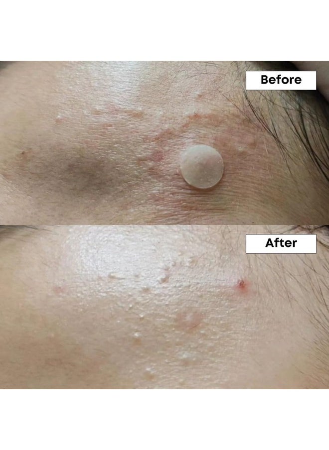 NINELESS A-Control 10% Azelaic Acid Serum