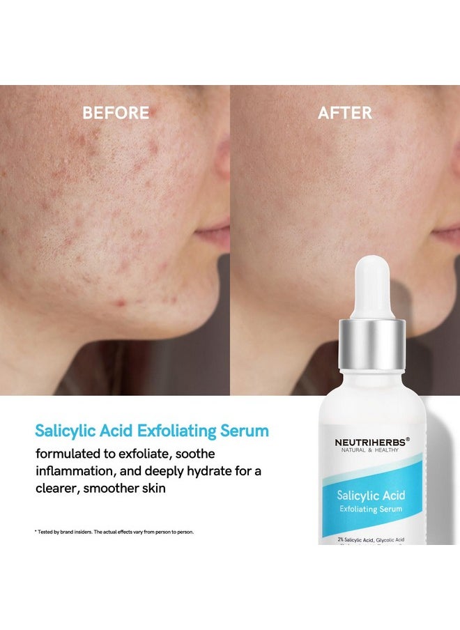 NEUTRIHERBS Salicylic Acid Exfoliating Serum, Unclogged And Minimized Pores, Face Serum For Acne Prone & Oily Skin - 1 fl oz