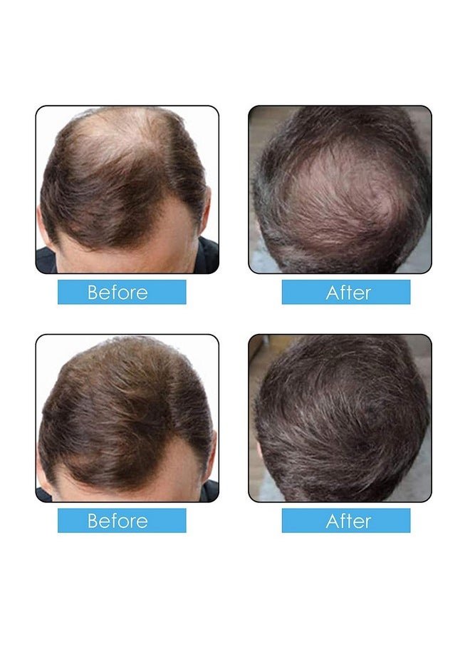 Hair Fibers Spray Refill Powder 100 Grams,Dark Brown,Thinning Fine Hair Loss Concealer,Undetected & Unscented,Refill Exsiting Shaker Bottle