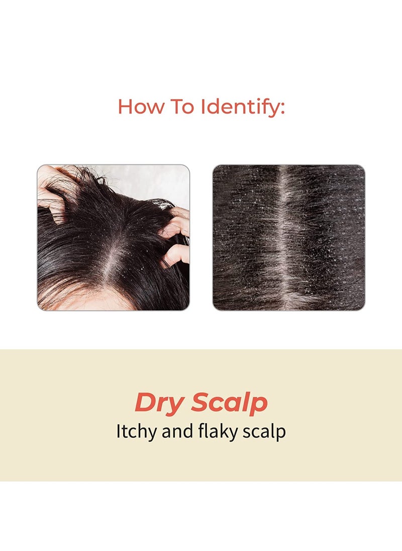 Customised Ayurvedic Hair Fall Oil | Vedix Shvedan Hair Fall Oil | For Dry Scalp | With Castor + Sesame + Olive | For Reducing Hair Fall | For Hair Growth | -100ml