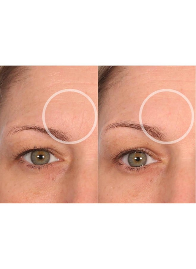 SiO Beauty BrowLift Forehead Anti-Wrinkle Patch - Expression Line Smoothing - Medical-Grade Silicone for Overnight Wrinkle Reduction & Anti-Aging Hydration, Reusable (10x)