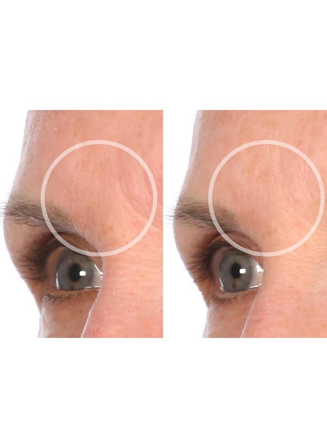 SiO Beauty BrowLift Forehead Anti-Wrinkle Patch - Expression Line Smoothing - Medical-Grade Silicone for Overnight Wrinkle Reduction & Anti-Aging Hydration, Reusable (10x)