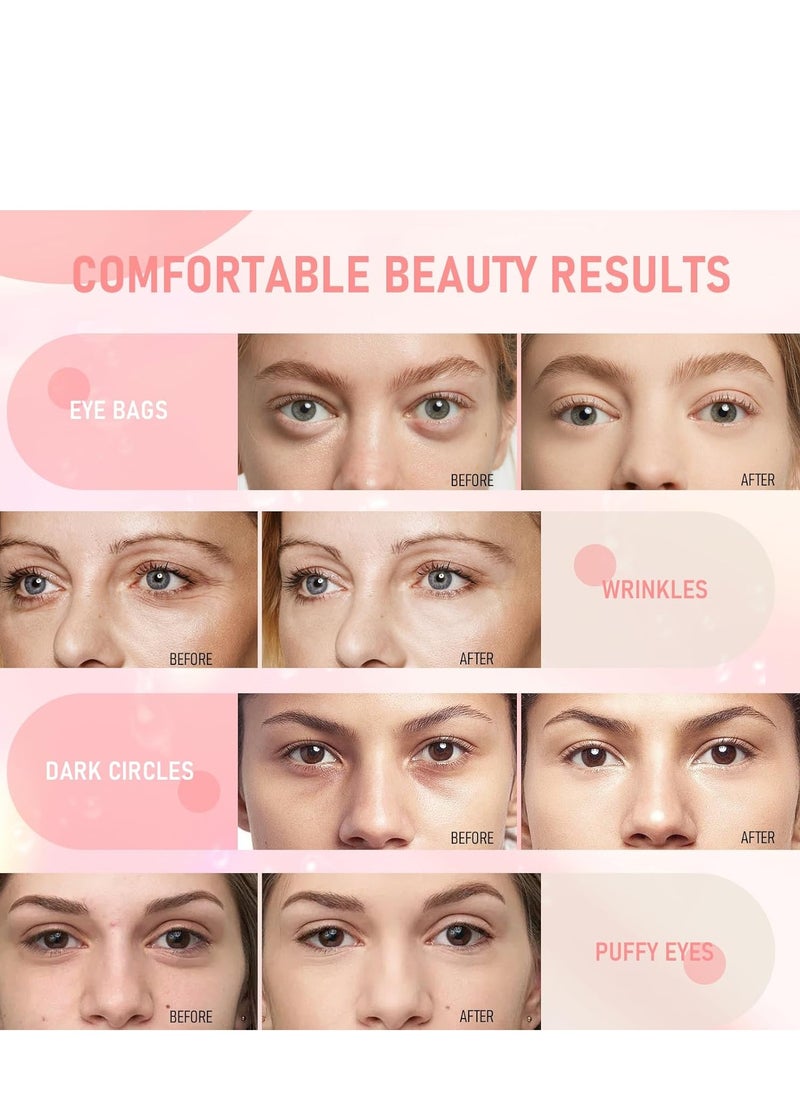 Eye Mask-30 Pairs Rose Under Eye Patches Skin Care Products,Eye Masks Skincare for Dark Circles and Puffiness, Reduce Wrinkles, Eye Bags and Fine Lines, for Women and Man