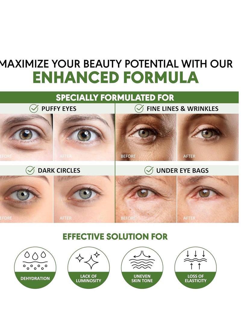 Eye Masks for Dark Circles and Puffiness – Hydrating Eye Patches with Collagen Hyaluronic Acid Green Tea & Aloe - Under Eye Treatment for Women and Men 30 Pairs