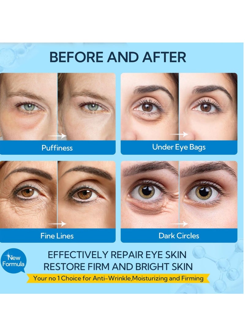 LANBENA Hyaluronic Acid Hydra-Gel Eye Mask Sheet Collagen Eye Patches Skin Care Eye Gel for Moisturizing Remove Dark Circles Eye Bag (30 Pairs)