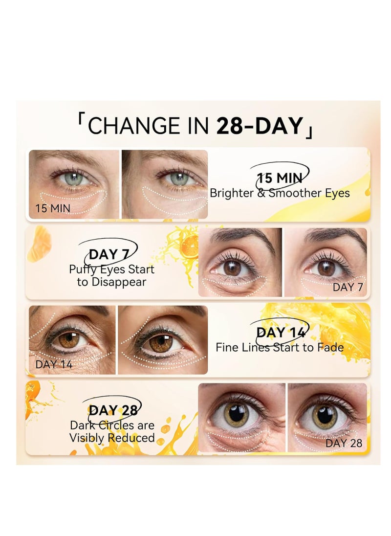 LANBENA Vitamin C Under Eye Patches for Dark Circles and Puffy Eyes, Cooling Eye Masks for Eye Bags, Fine Lines & Wrinkles Reduce, Anti-Aging, with Niacinamide Hydra-Gel Collagen-30 Pairs