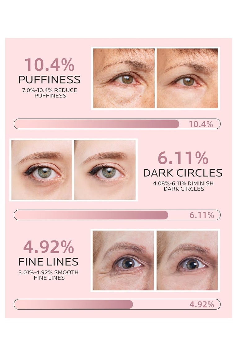 Dr. Pure Under Eye Patches for Puffiness: Caffeine Eye Mask for Dark Circles and Puffy Eyes with Niacinamide Hyaluronic Acid - Smooth Wrinkles Reduce Eye Bags Undereye Gel Pad (50 Pairs)