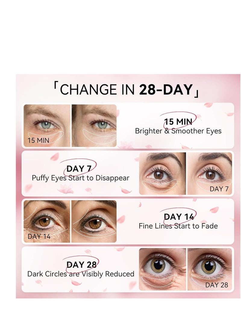 BREYLEE Rose Eye Mask - 60 Pcs Under Eye Treatment for Puffy Eyes, Wrinkles, Dark Circles and Fine Lines (Rose)