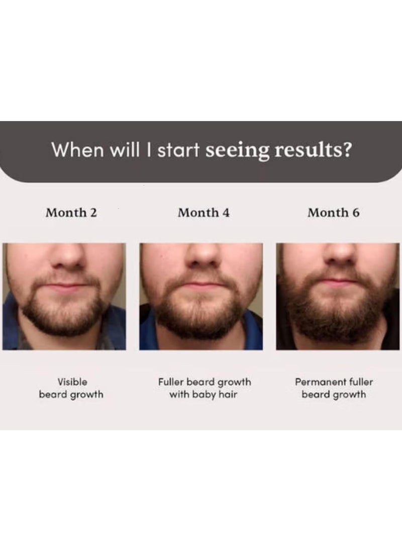 Beardmax Growth Serum 30ml | 5% Minoxidil | Activates Beard Follicles | Solves Uneven & Patchy Beard