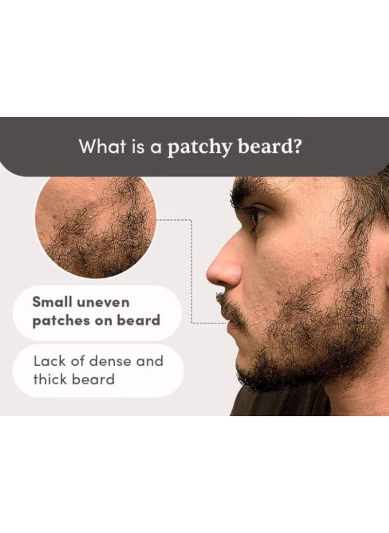 Beardmax Growth Serum 30ml | 5% Minoxidil | Activates Beard Follicles | Solves Uneven & Patchy Beard