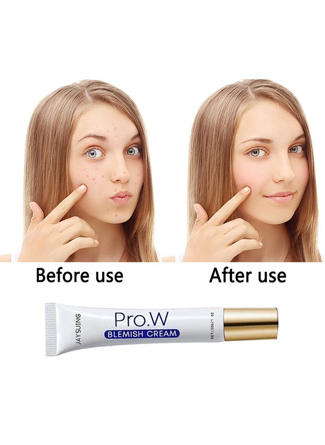 Blemish Cream, Facial Oil Control Acne Cream, for Fast Acne Removal for Oily and Acne-prone Skin, Non-Irritant, Women 30g