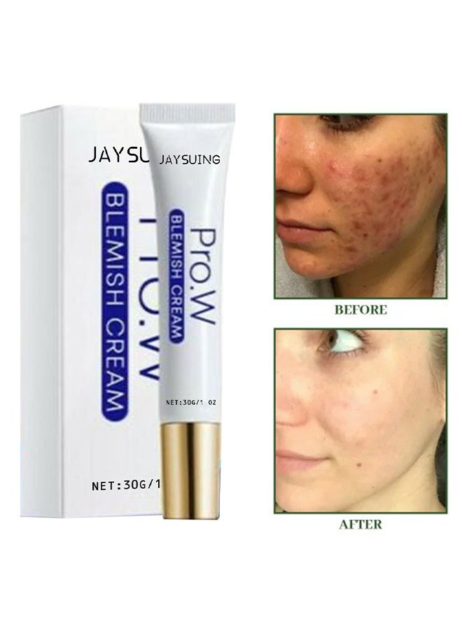 Blemish Cream, Facial Oil Control Acne Cream, for Fast Acne Removal for Oily and Acne-prone Skin, Non-Irritant, Women 30g