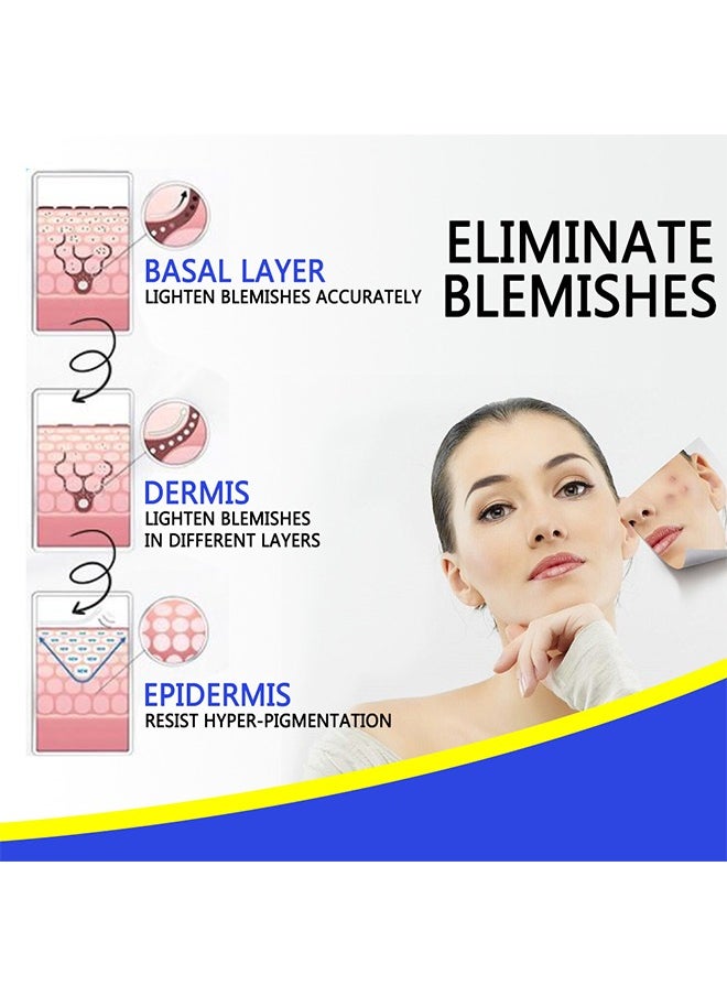 Blemish Cream, Facial Oil Control Acne Cream, for Fast Acne Removal for Oily and Acne-prone Skin, Non-Irritant, Women 30g