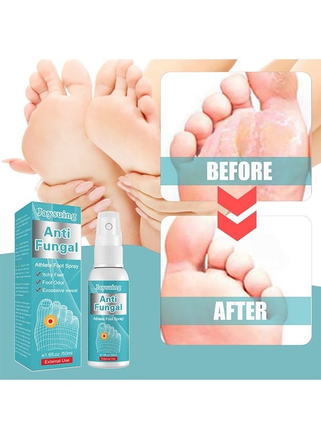 Anti Fungal Athletes Foot Spray- Prevent Athlete's Foot,Smelly Feet,Relieve Itching of Feet, Sweating, Peeling And Blisters, Natural Ingredients Foot Fungi Spray For Tinea Pedis 50ML