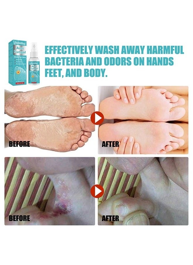 Anti Fungal Athletes Foot Spray- Prevent Athlete's Foot,Smelly Feet,Relieve Itching of Feet, Sweating, Peeling And Blisters, Natural Ingredients Foot Fungi Spray For Tinea Pedis 50ML