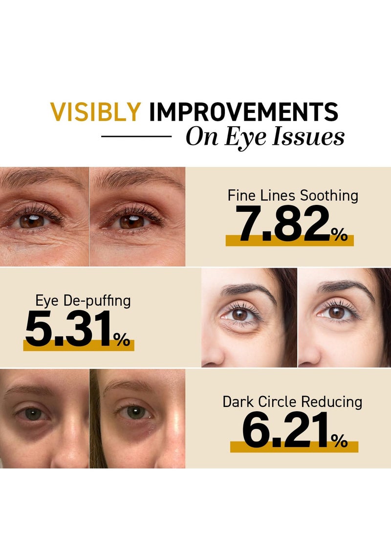 CITYGOO Eye Cream For Dark Circles: Eye Puffiness Under Eye Bags Treatment - Anti-Wrinkle (Snail Eye Stick 1 Count)