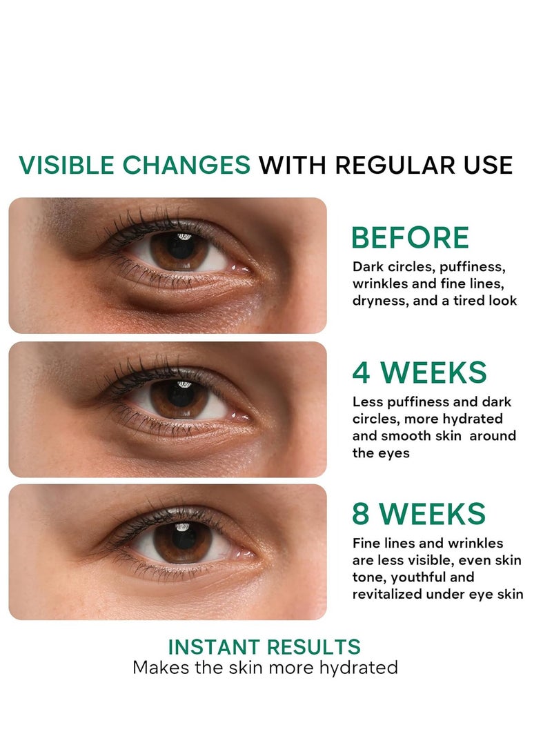 REMEDIAL PAX Eye Cream for Dark Circles and Puffiness, Bags Under Eyes Treatment, Anti-Aging Collagen Eye Cream for Wrinkles, Day & Night Caffeine Eye Cream with Niacinamide Dimethicone
