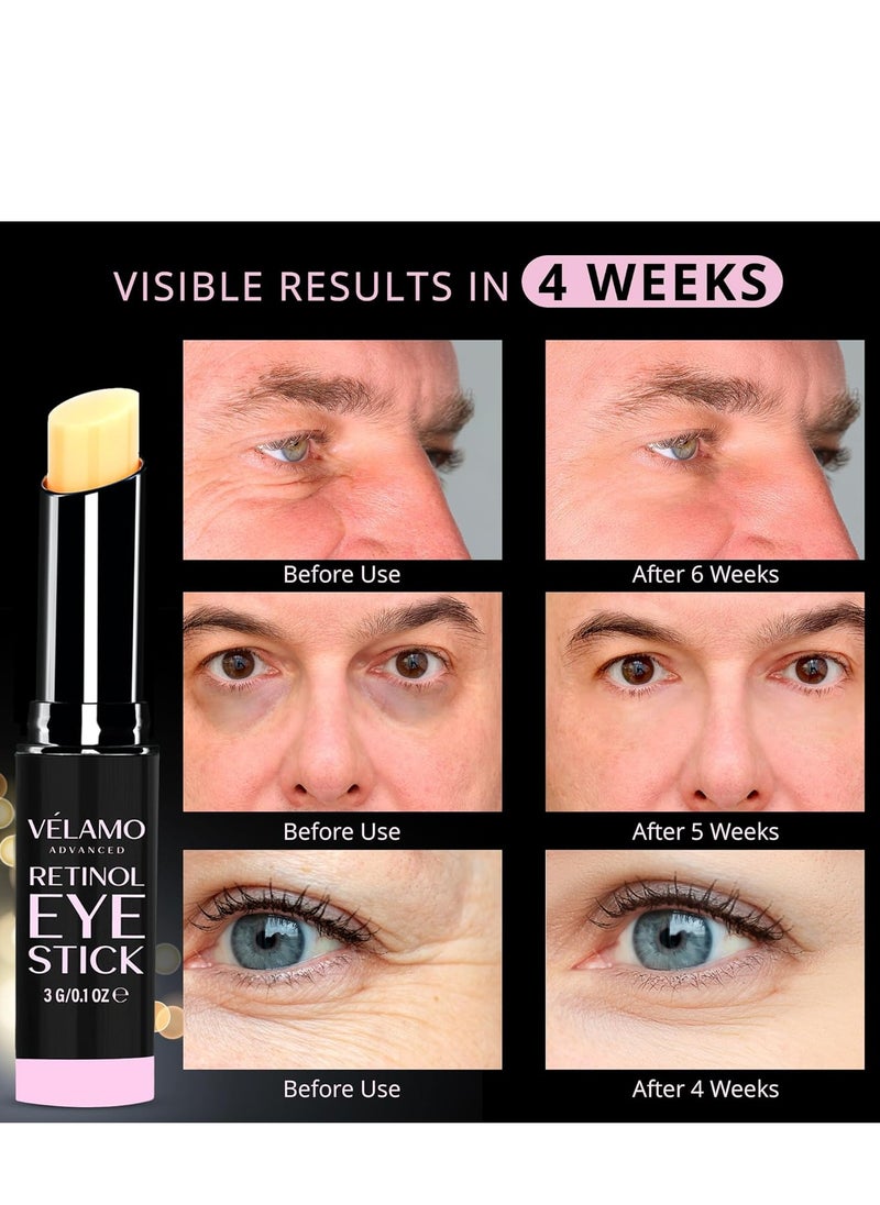 VELAMO ADVANCED Retinol Eye Stick: Retinol Eye Cream for Dark Circles and Puffiness with 1% Bakuchiol and Caffeine - Visibly Reduces Fine Lines Wrinkles Under Eye Bags with Upgraded Formula 0.1 OZ/3g