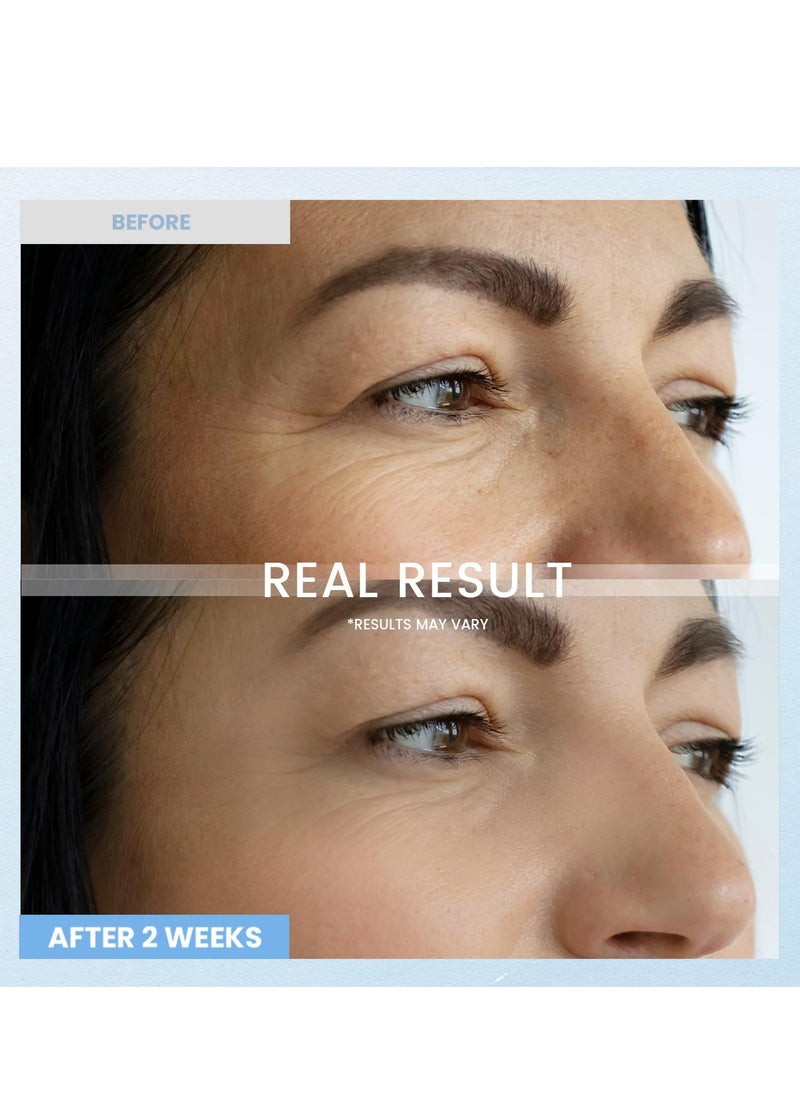 Retinol Eye Cream for Dark Circles: Anti-Wrinkle Under Eye Cream - Night Care Eye Cream Reduces Eye Bags