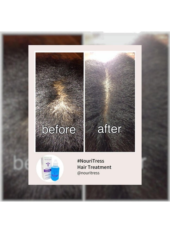 NouriTress Perfect Hair Follicle Therapy | Strengthens Hair at the Root | Thinning Hair Formula Serum To Enhance Growth | Nourishes Scalp | 2 FL. OZ
