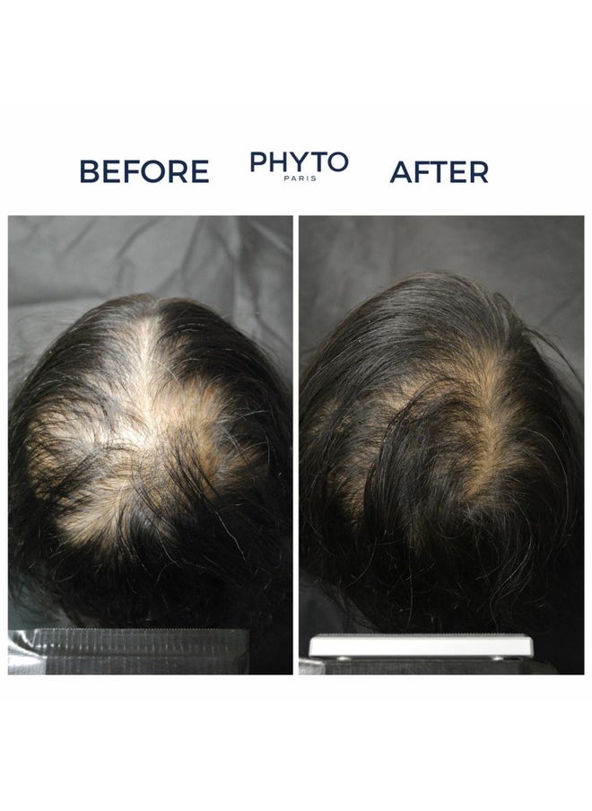 PHYTOCYANE Women Densifying Treatment for Progressive Hair Thinning, Aging, Menopause, Hereditary, 12 Vials x 0.169 fl.oz. (1 month Supply)