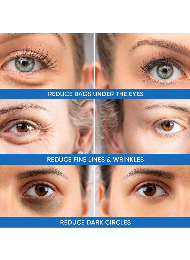 Under Eye Puffiness & Dark Circles Rapid Treatment- Instantly Reduces the Appearance of Puffy Eye Bags, Crow’s Feet, & Sagging Skin.