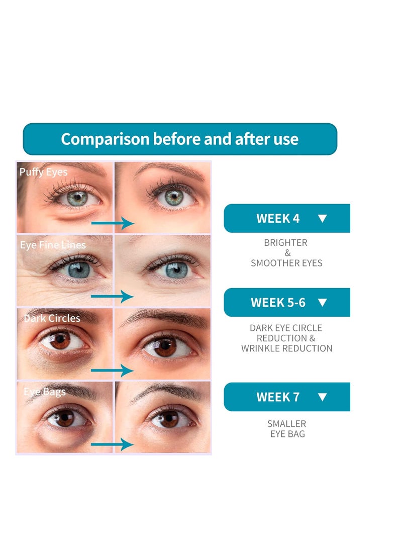 LANBENA Eye Cream for Wrinkles, Anti-Aging Eye Cream with Hyaluronic Acid, Reduce Fine Lines, Firm Eye Skin, Puffy Eyes and Dark Circles Treatments