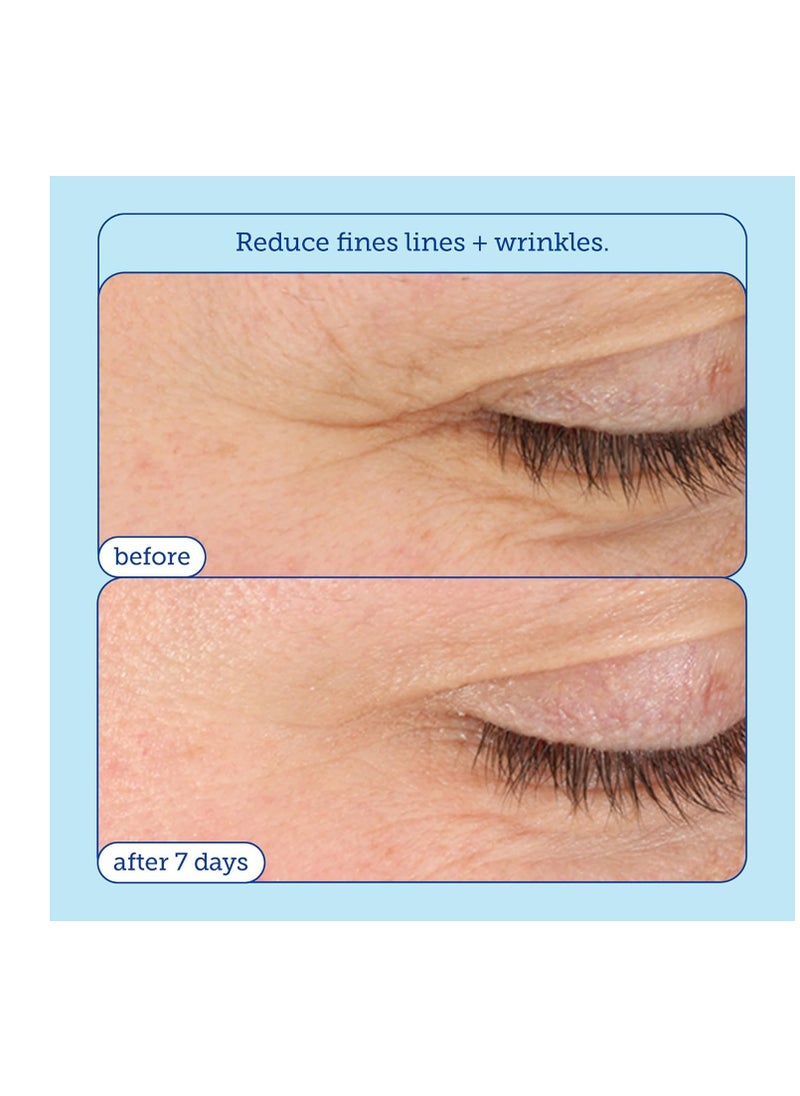 Skinfix Barrier+ Triple Lipid-Boost 360° Eye Cream: Targets Dark Circles, Puffiness, and Fine Lines Around Eyes and Lids, Clinically Proven to Brighten and Refresh Eyes, 0.5 oz