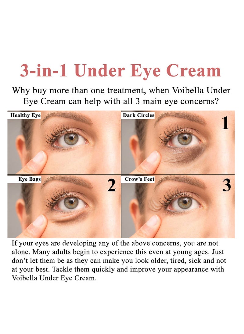 Anti-Aging Under Eye Cream, 3-in-1 Treatment For Dark Circles, Puffy Eyes, Bags & Wrinkles - Firming, Moisturizing & Hydrating - Natural Cucumber, Collagen, Hyaluronic Acid, Retinol, Vitamin E