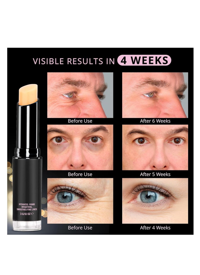 VELAMO ADVANCED Retinol Eye Stick: Retinol Eye Cream for Dark Circles and Puffiness with 1% Bakuchiol and Caffeine - Visibly Reduces Fine Lines Wrinkles Under Eye Bags with Upgraded Formula 0.1 OZ/3g