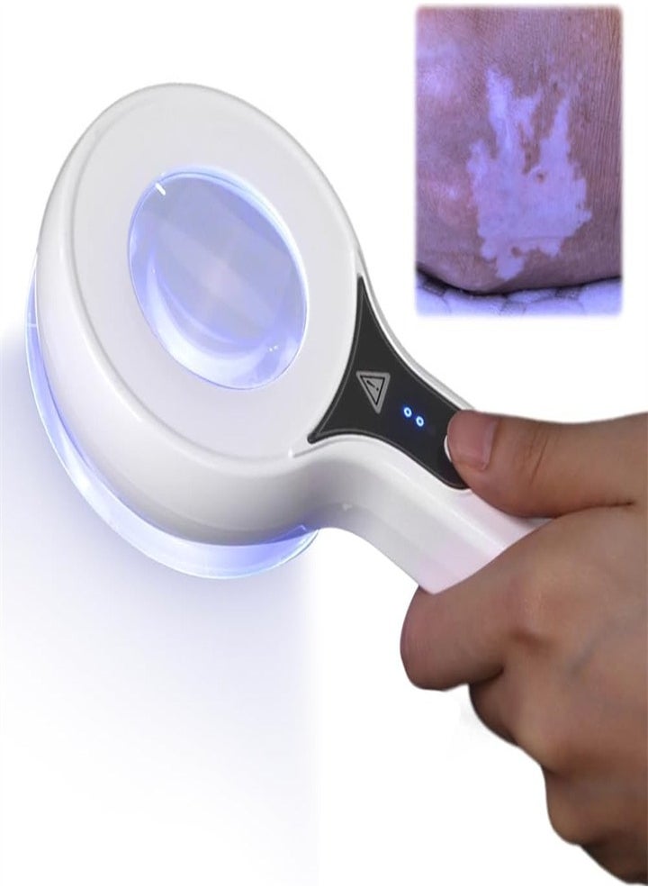 Portable Woods Lamp, Skin Analyzer Professional Facial Magnification Analyzer Rechargeable Skin Detector for Beauticians/Skin Test/Pet Urine Detector